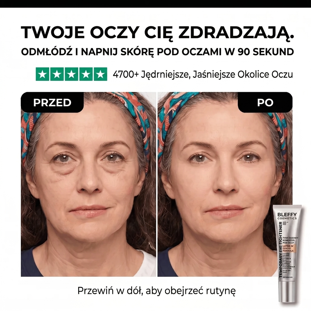 Szybki sposób na worki pod oczami w 90 sekund